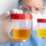 What Are the Different Urine Tests Available and the Advantages of Urine Sample Collection?
